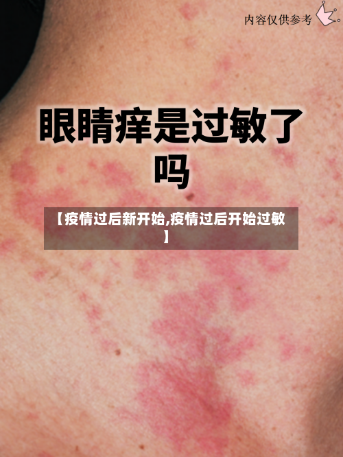 【疫情过后新开始,疫情过后开始过敏】-第2张图片
