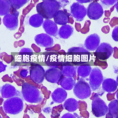 细胞疫情/疫情细胞图片